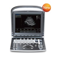 Chison Portable Ultrasound Scanner ECO1