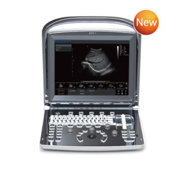 Chison Portable Ultrasound Scanner ECO1